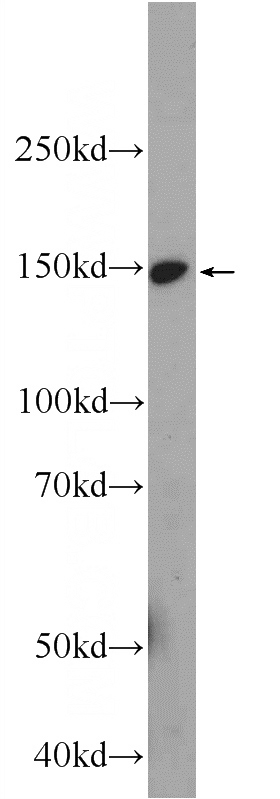 HeLa cells were subjected to SDS PAGE followed by western blot with Catalog No:115220(SETBP1 Antibody) at dilution of 1:300
