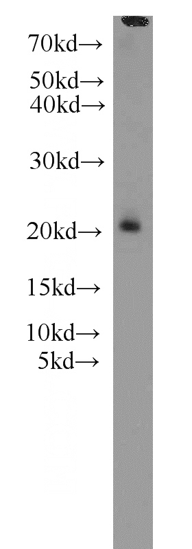 mouse heart tissue were subjected to SDS PAGE followed by western blot with Catalog No:116132(TIMM17B antibody) at dilution of 1:600