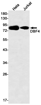 Western blot detection of DBF4 in Hela,Jurkat cell lysates using DBF4 Rabbit mAb(1:500 diluted).Predicted band size:77kDa.Observed band size:77kDa.