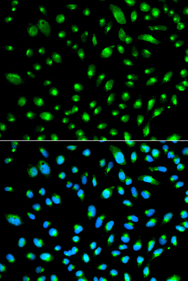Immunofluorescence - WT1 Polyclonal Antibody 