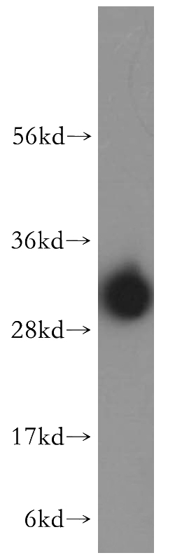 HeLa cells were subjected to SDS PAGE followed by western blot with Catalog No:112769(MTERF antibody) at dilution of 1:400