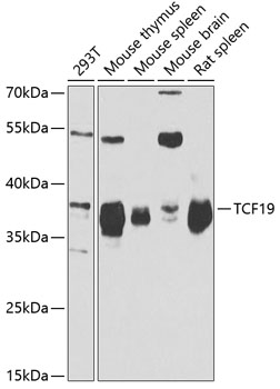 Western blot - TCF19 Polyclonal Antibody 