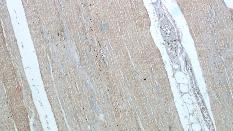 Immunohistochemistry of paraffin-embedded human skeletal muscle tissue slide using Catalog No:113465(OBSCN Antibody) at dilution of 1:50 (under 10x lens)
