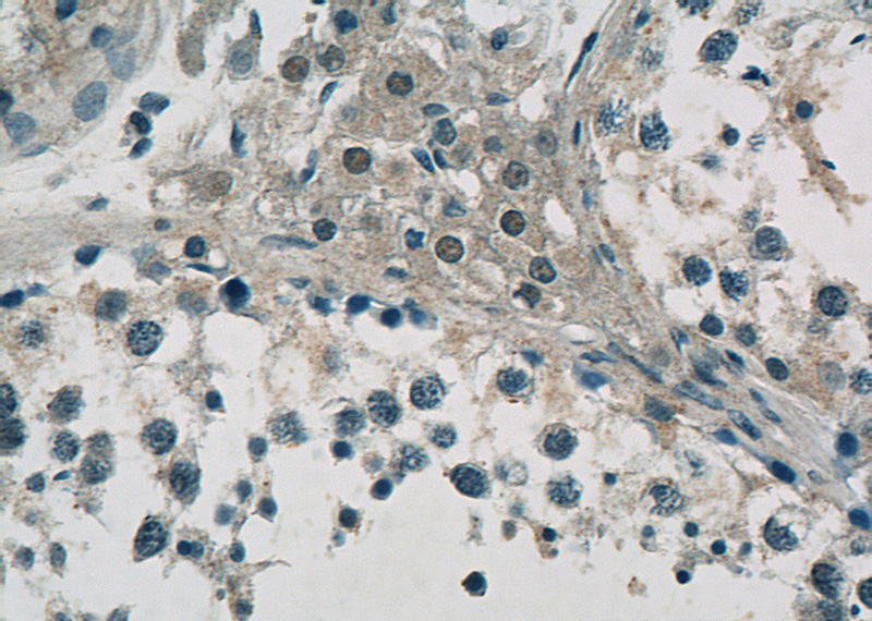 Immunohistochemistry of paraffin-embedded human testis slide using Catalog No:108562(C10orf27 Antibody) at dilution of 1:50