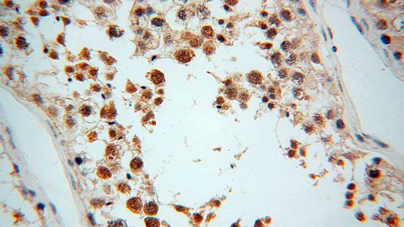 Immunohistochemical of paraffin-embedded human testis using Catalog No:112385(MAGEB18 antibody) at dilution of 1:100 (under 40x lens)