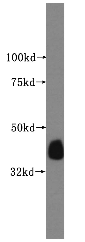 human colon tissue were subjected to SDS PAGE followed by western blot with Catalog No:109580(CRTAP antibody) at dilution of 1:500