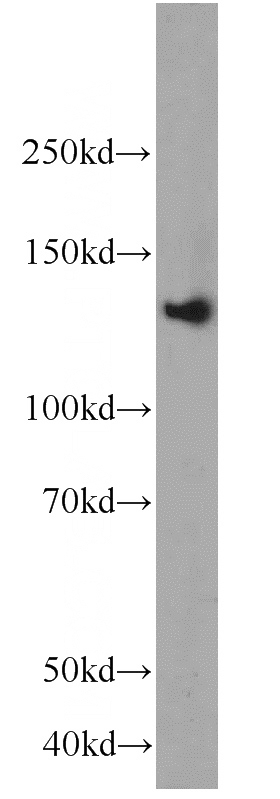 rat brain tissue were subjected to SDS PAGE followed by western blot with Catalog No:114477(RASGRF1 antibody) at dilution of 1:600