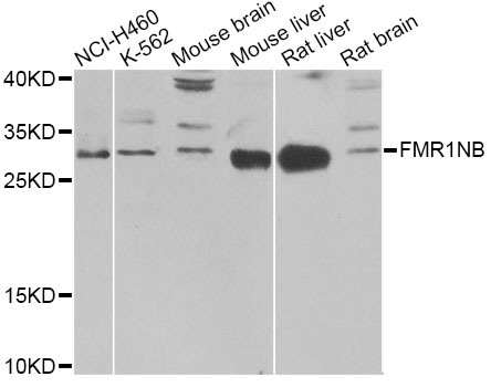 Western blot - FMR1NB Polyclonal Antibody 