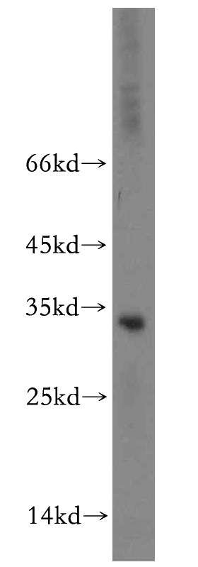 mouse spleen tissue were subjected to SDS PAGE followed by western blot with Catalog No:114808(RPIA antibody) at dilution of 1:500
