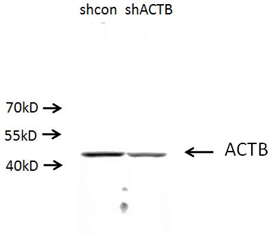 A549 cells (shcontrol and shRNA of Beta actin) were subjected to SDS PAGE followed by western blot with Catalog No:117305(ACTB antibody) at dilution of 1:500. (Data provided by Angran Biotech (www.miRNAlab.com)).