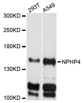 Western blot - NPHP4 Polyclonal Antibody 