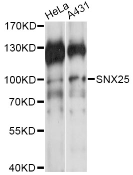 Western blot - SNX25 Polyclonal Antibody 