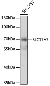 Western blot - SLC17A7 Polyclonal Antibody 
