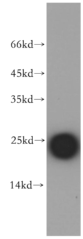 human placenta tissue were subjected to SDS PAGE followed by western blot with Catalog No:109596(CSHL1 antibody) at dilution of 1:1000