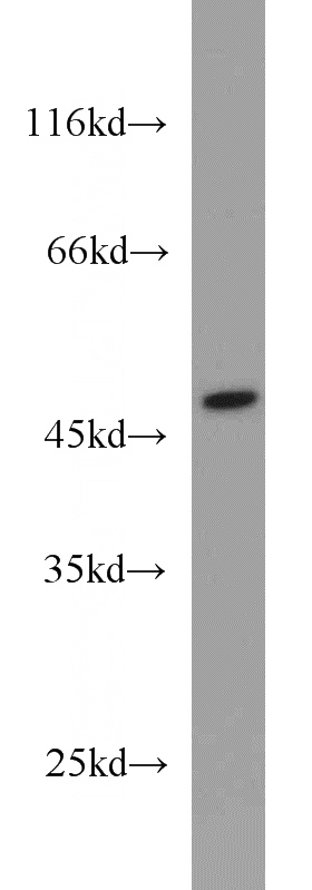 Jurkat cells were subjected to SDS PAGE followed by western blot with Catalog No:111243(GTPBP3 antibody) at dilution of 1:500