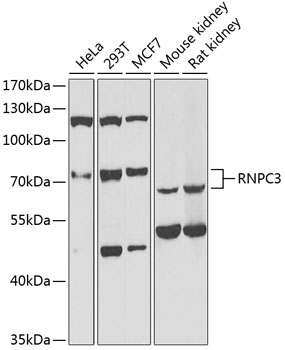 Western blot - RNPC3 Polyclonal Antibody 