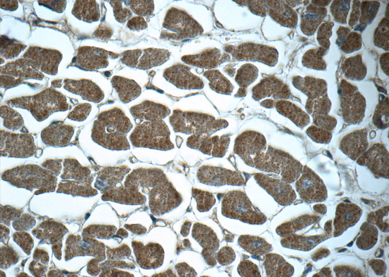 Immunohistochemistry of paraffin-embedded human heart tissue slide using Catalog No:113079(NDUFC1 Antibody) at dilution of 1:50 (under 40x lens)