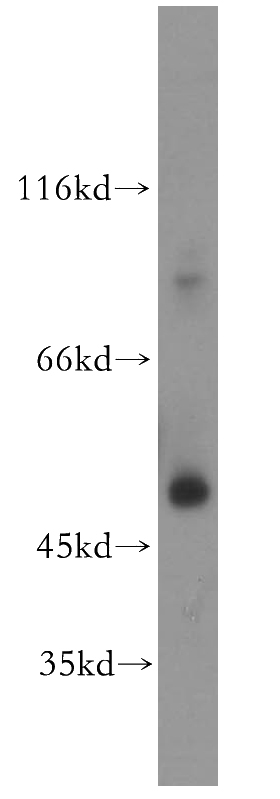 human brain tissue were subjected to SDS PAGE followed by western blot with Catalog No:115247(SIRT6 antibody) at dilution of 1:400