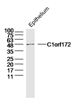 Fig1: Sample:Epithelium (Mouse) Lysate at 40 ug; Primary: Anti-C1orf172 at 1/300 dilution; Secondary: IRDye800CW Goat Anti-Rabbit IgG at 1/20000 dilution; Predicted band size: 44 kD; Observed band size: 48 kD