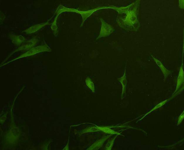 Fig5: ICC staining GAP43 in A172 cells (green). Cells were fixed in paraformaldehyde, permeabilised with 0.25% Triton X100/PBS.