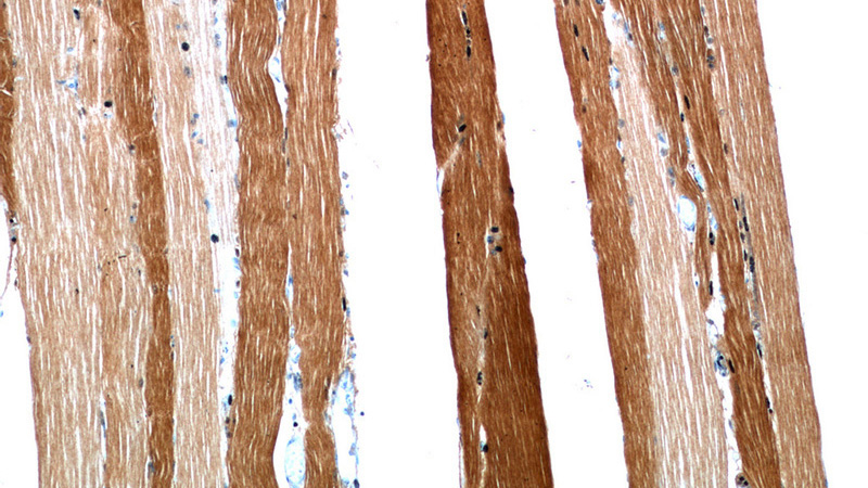 Immunohistochemical of paraffin-embedded human skeletal muscle using Catalog No:110254(ENO3 antibody) at dilution of 1:50 (under 10x lens)