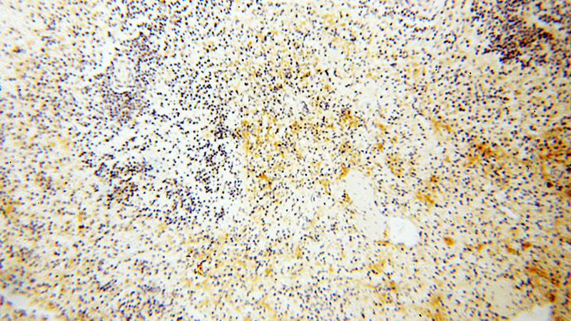 Immunohistochemical of paraffin-embedded human spleen using Catalog No:115052(SAMD4A antibody) at dilution of 1:100 (under 10x lens)