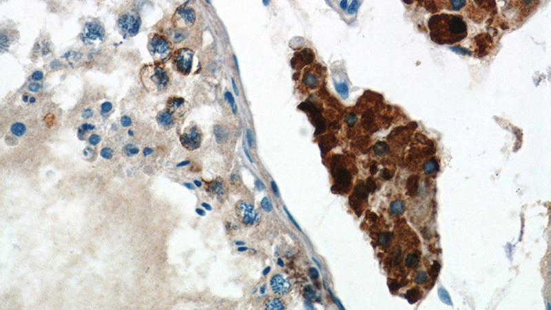 Immunohistochemistry of paraffin-embedded human testis tissue slide using Catalog No:116620(UNG Antibody) at dilution of 1:50 (under 40x lens)