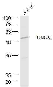 Fig3: Sample:; Jurkat(Human) Cell Lysate at 30 ug; Primary: Anti-UNCX at 1/5000 dilution; Secondary: IRDye800CW Goat Anti-Rabbit IgG at 1/20000 dilution; Predicted band size: 54 kD; Observed band size: 54 kD
