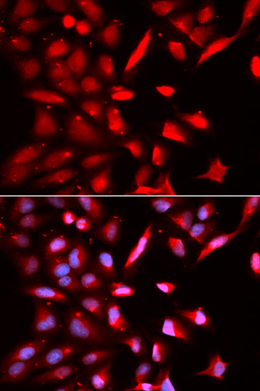 Immunofluorescence - PSMC3 Polyclonal Antibody 