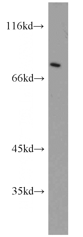 Y79 cells were subjected to SDS PAGE followed by western blot with Catalog No:112901(MKLN1 antibody) at dilution of 1:1000