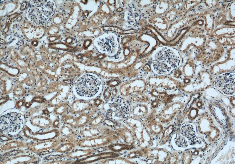 Immunohistochemical of paraffin-embedded human kidney using Catalog No:117045(ZFYVE16 antibody) at dilution of 1:200 (under 10x lens)