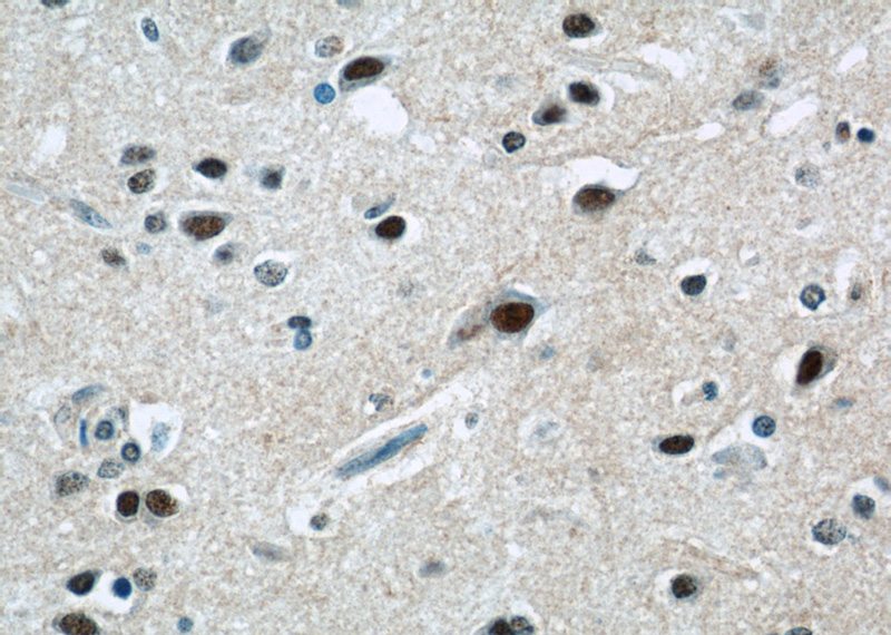Immunohistochemical of paraffin-embedded human brain using Catalog No:117009(ZNF597 antibody) at dilution of 1:50 (under 40x lens)