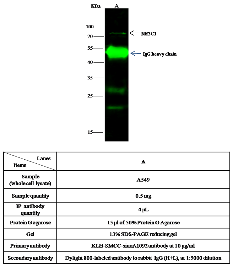 Human NR3C1 Immunoprecipitation(IP) 14607