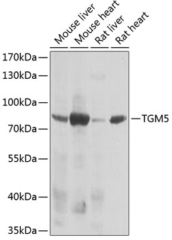 Western blot - TGM5 Polyclonal Antibody 