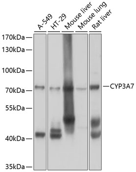 Western blot - CYP3A7 Polyclonal Antibody 