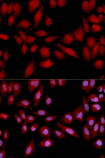 Immunofluorescence - PSMA2 Polyclonal Antibody 