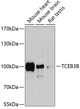 Western blot - TCEB3B Polyclonal Antibody 