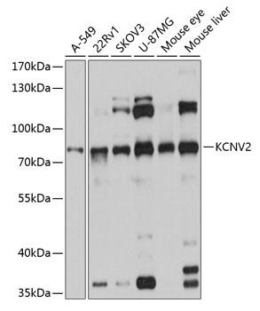 Western blot - KCNV2 Polyclonal Antibody 