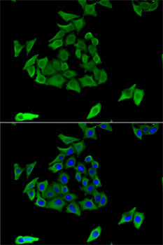 Immunofluorescence - TGM3 Polyclonal Antibody 