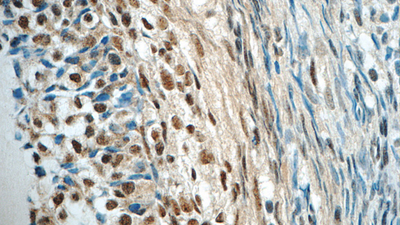 Immunohistochemistry of paraffin-embedded human ovary tissue slide using Catalog No:115108(SENP1 Antibody) at dilution of 1:50 (under 40x lens)