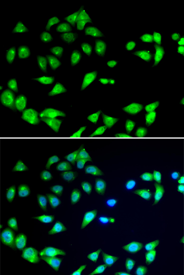 Immunofluorescence - ARFGAP1 Polyclonal Antibody 