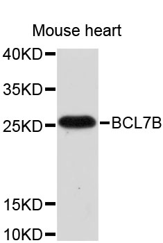 Western blot - BCL7B Polyclonal Antibody 
