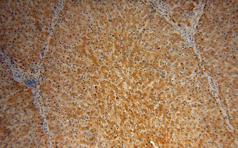 Immunohistochemical of paraffin-embedded human liver using Catalog No:110623(AHSG antibody) at dilution of 1:200 (under 10x lens)