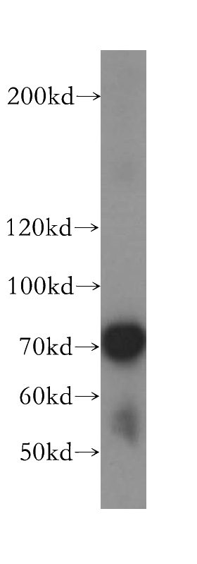 MCF7 cells were subjected to SDS PAGE followed by western blot with Catalog No:116487(TUBGCP4 antibody) at dilution of 1:500