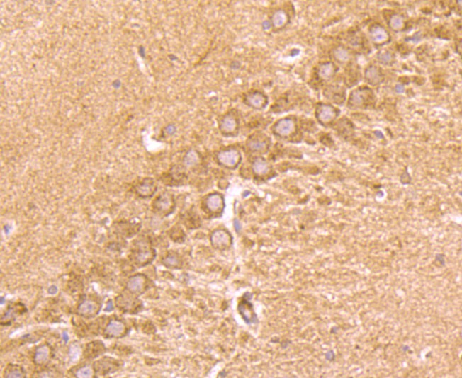Fig6: Immunohistochemical analysis of paraffin-embedded rat hippocampus tissue using anti-CD137 antibody. Counter stained with hematoxylin.