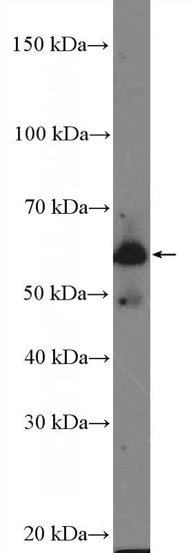 human testis tissue were subjected to SDS PAGE followed by western blot with Catalog No:115556(SPATC1 Antibody) at dilution of 1:600