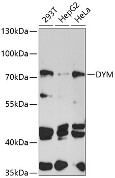 Western blot - DYM Polyclonal Antibody 