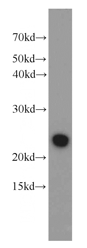 K-562 cells were subjected to SDS PAGE followed by western blot with Catalog No:114528(CRADD antibody) at dilution of 1:1000