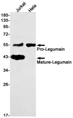 Western blot detection of Legumain in Jurkat,Hela cell lysates using Legumain Rabbit mAb(1:1000 diluted).Predicted band size:49kDa.Observed band size:56,46,37kDa.