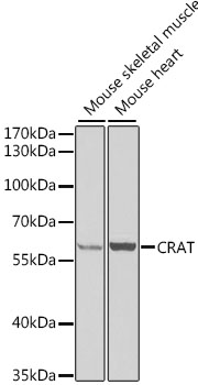 Western blot - CRAT Polyclonal Antibody 